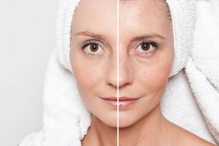 Retarder le vieillissement de la peau avec les soins anti-âge